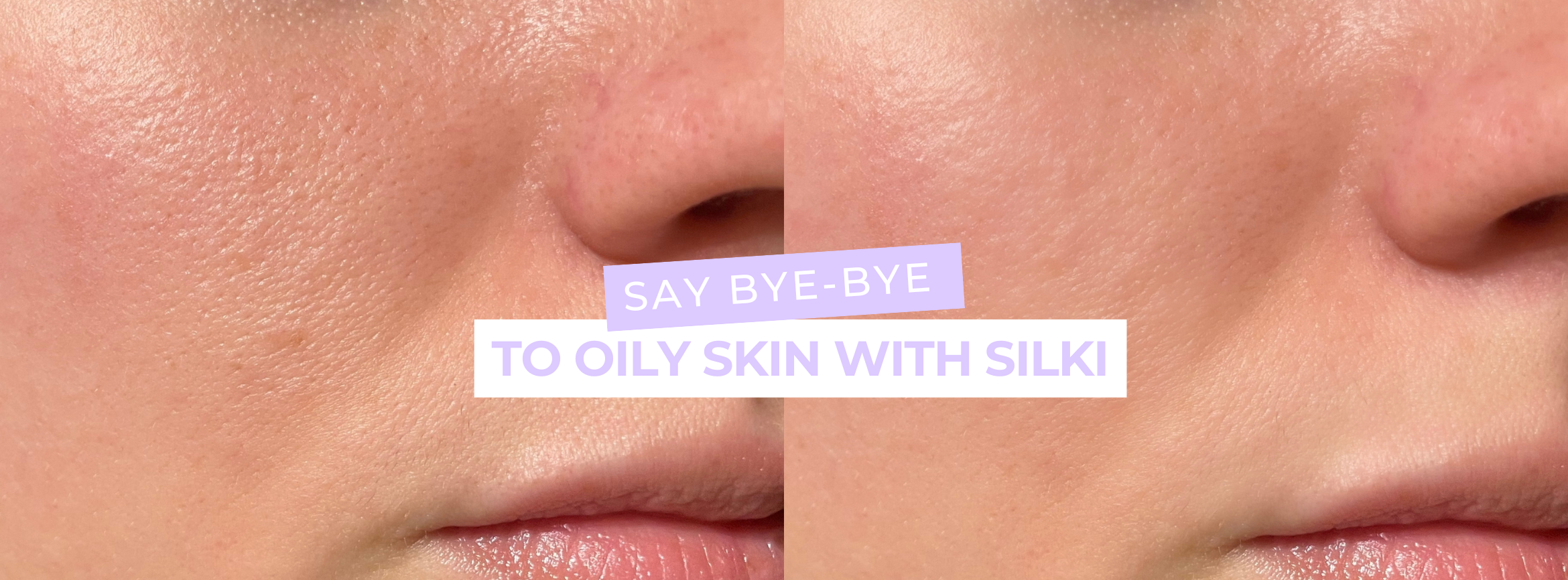 Say Bye-Bye to Oily Skin with Silki