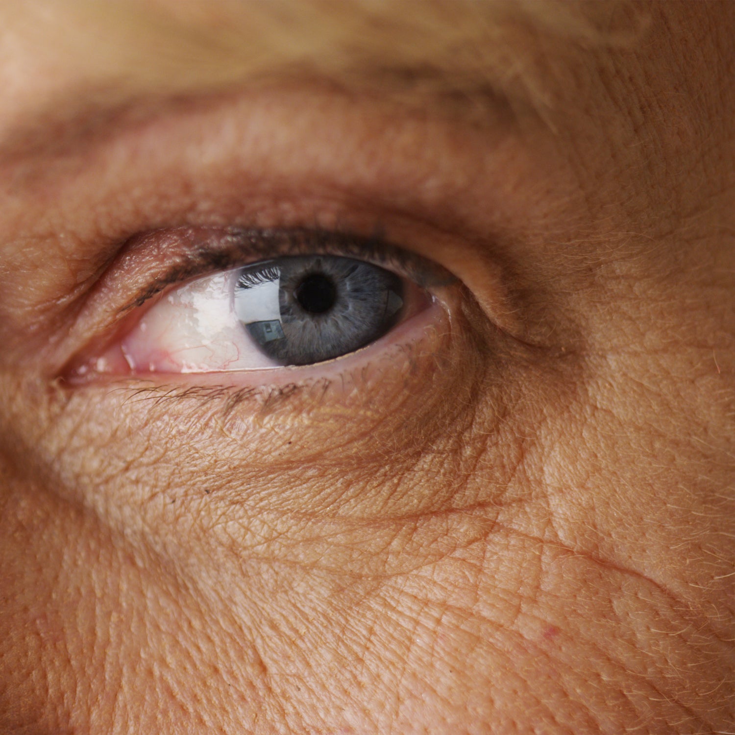 Fine Lines & Wrinkles