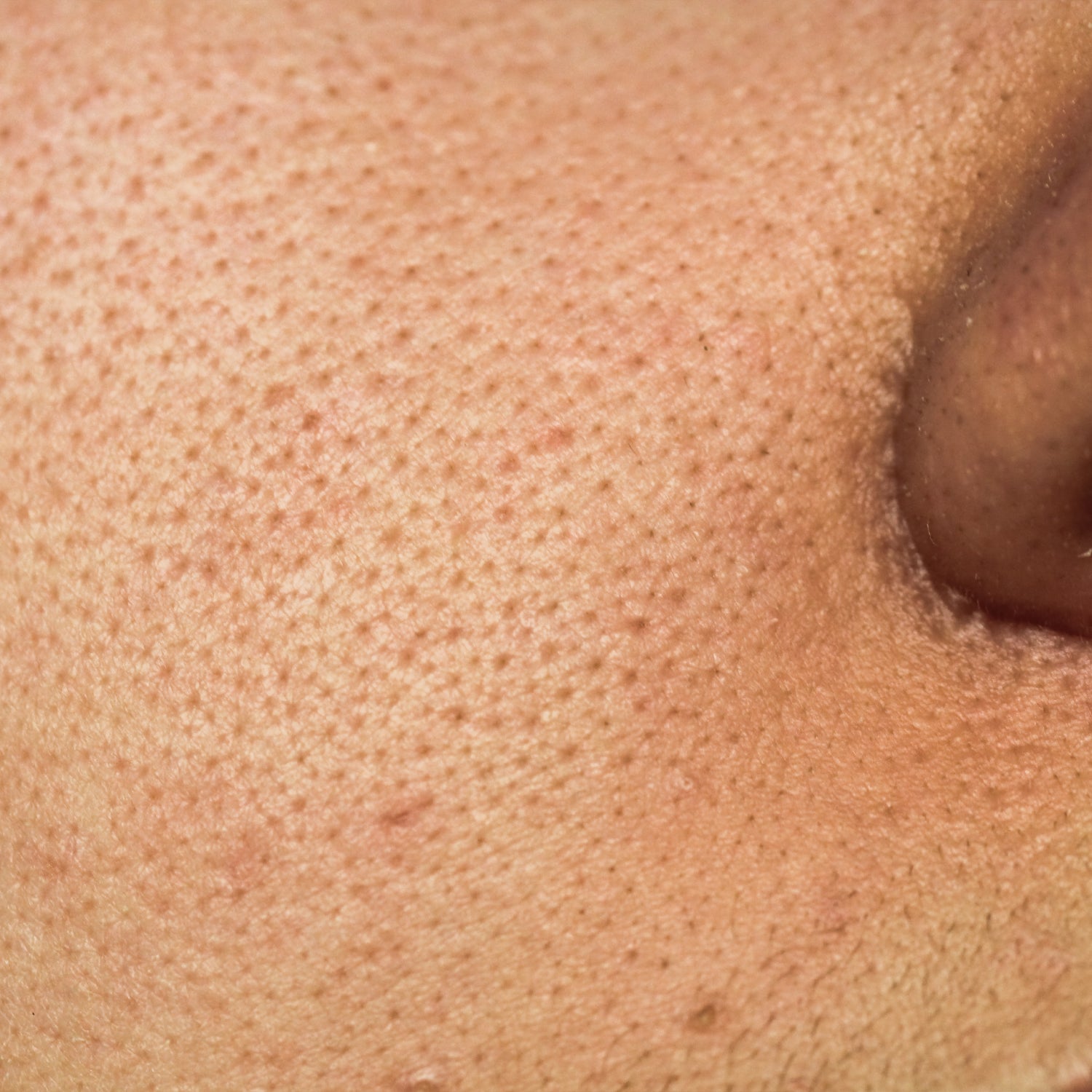 Pores & Oil Control