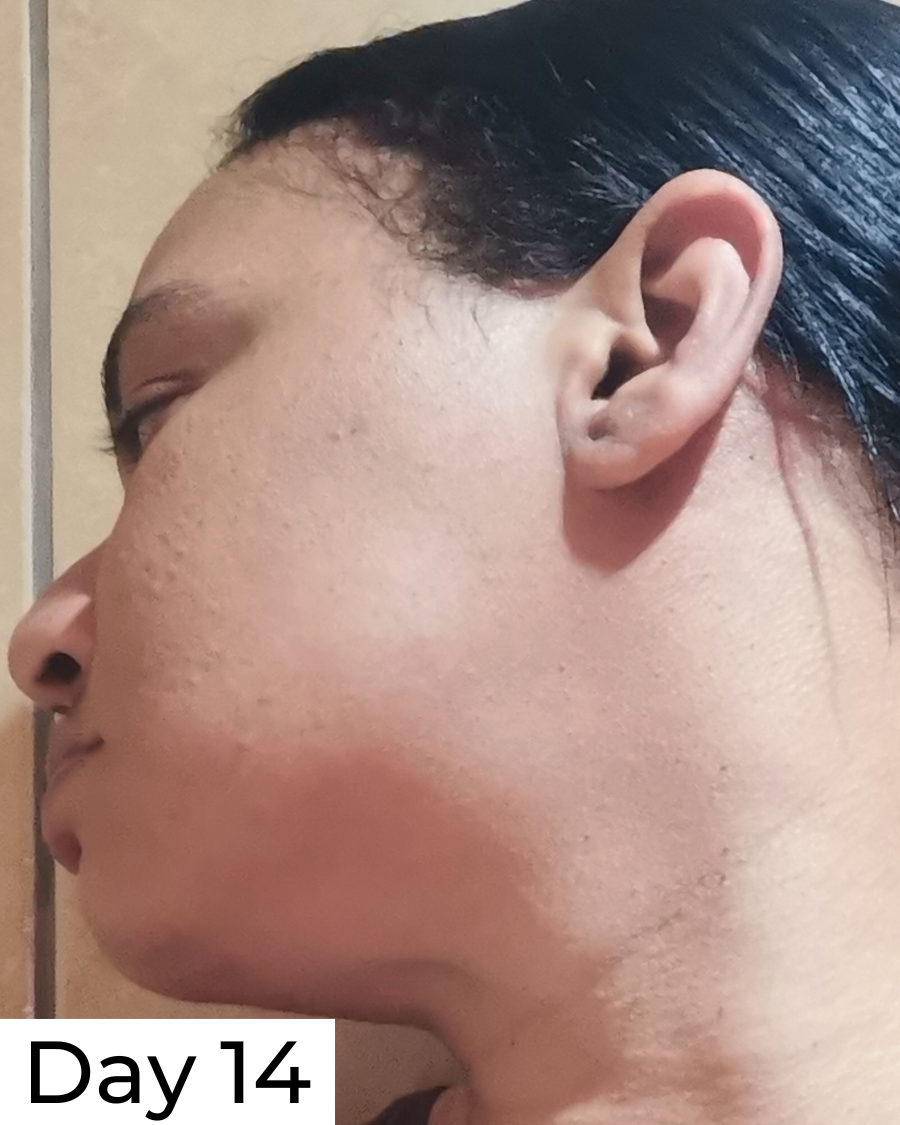 Hypochlorous Acid Daily Spritz