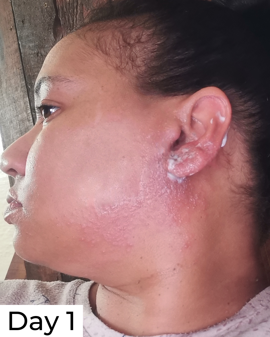 Hypochlorous Acid Daily Spritz