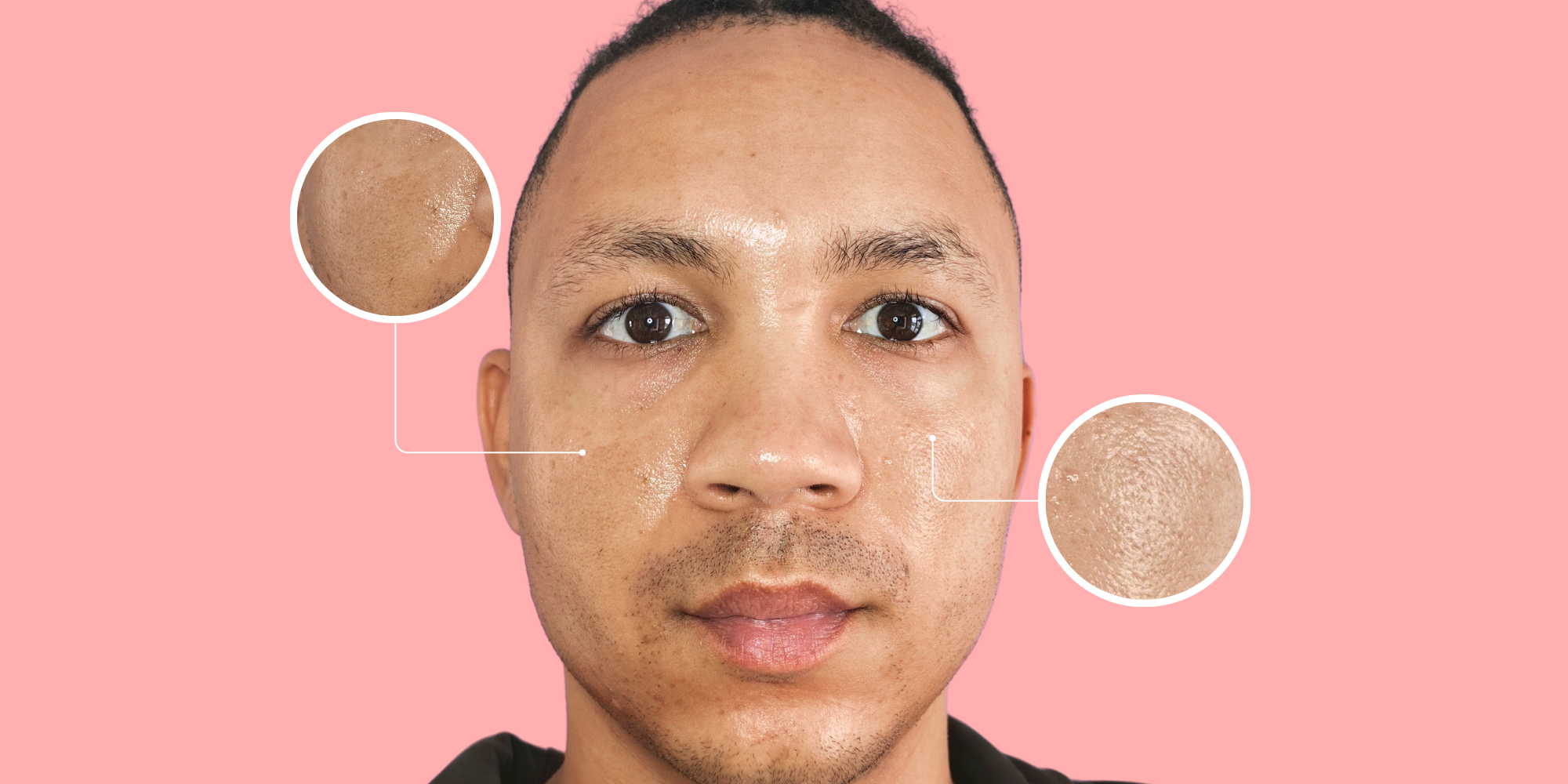 The Real Reason Your Skin Looks Oily and Your Pores Look Bigger