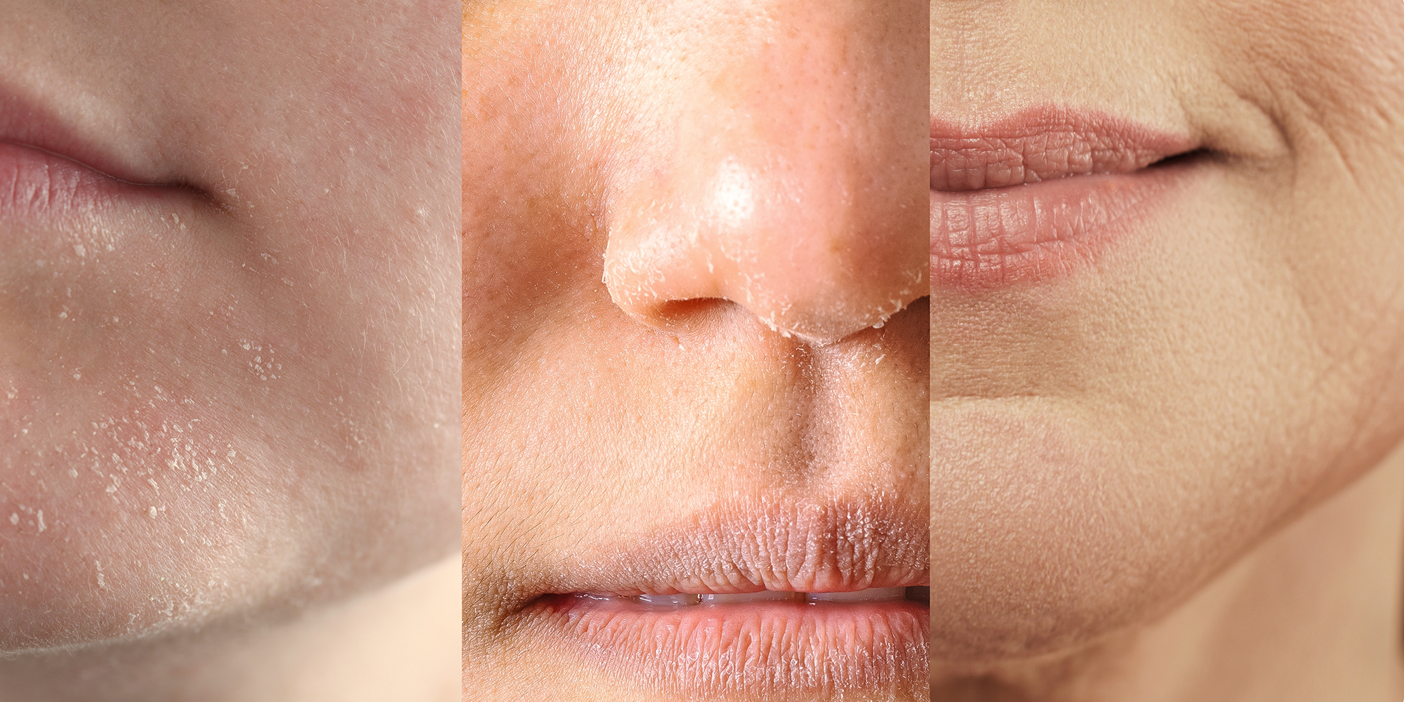 Your Skin Barrier: Why It Matters and How to Care for It