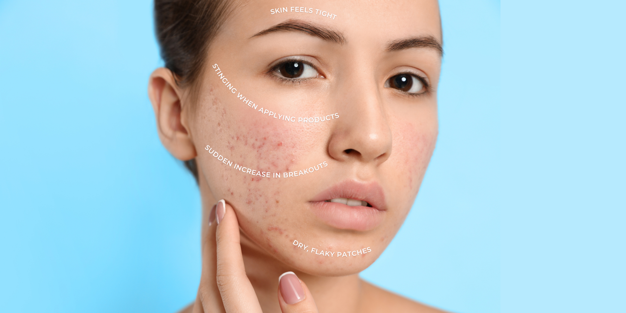 Are You Exfoliating Too Much? Here’s How to Know (and Fix It Fast)